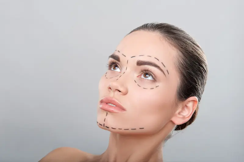 Facelift and Rhinoplasty: Harmonizing Facial Features