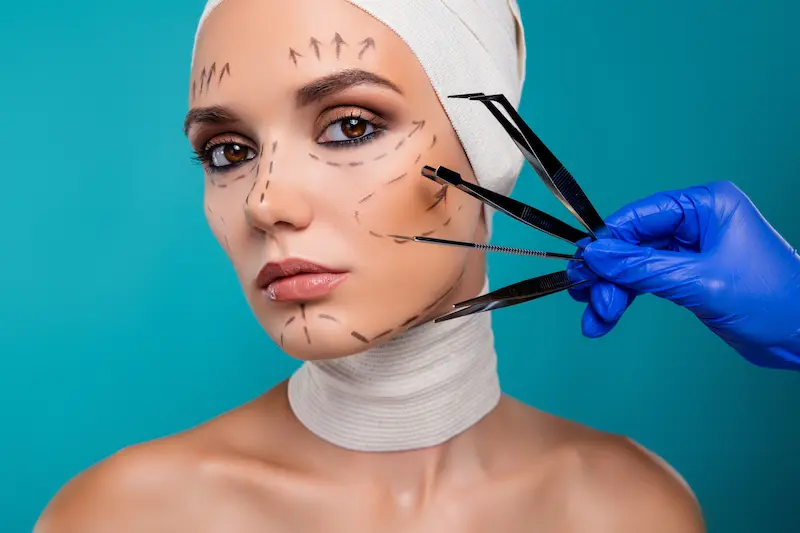 Revision Facelift Surgery