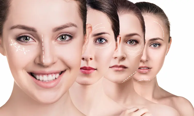 Dealing with Bruising and Swelling