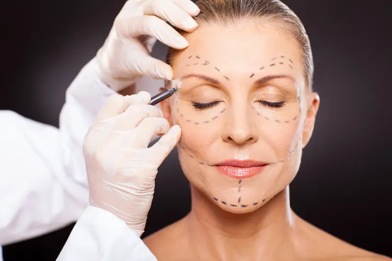 Meet the Top Facelift Surgeons in Turkey